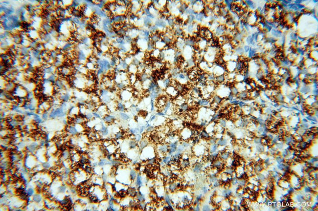 P2RY1 Antibody in Immunohistochemistry (Paraffin) (IHC (P))