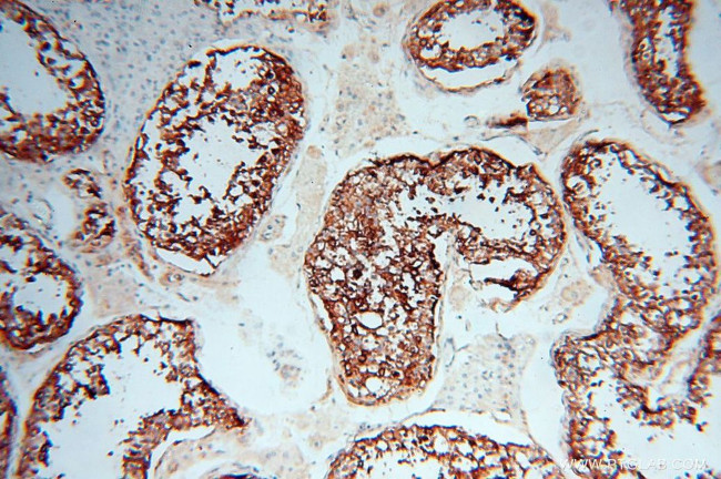 P2RY1 Antibody in Immunohistochemistry (Paraffin) (IHC (P))