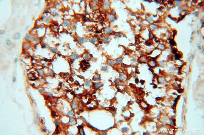 P2RY1 Antibody in Immunohistochemistry (Paraffin) (IHC (P))