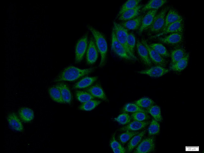 ATP6V0D1 Antibody in Immunocytochemistry (ICC/IF)