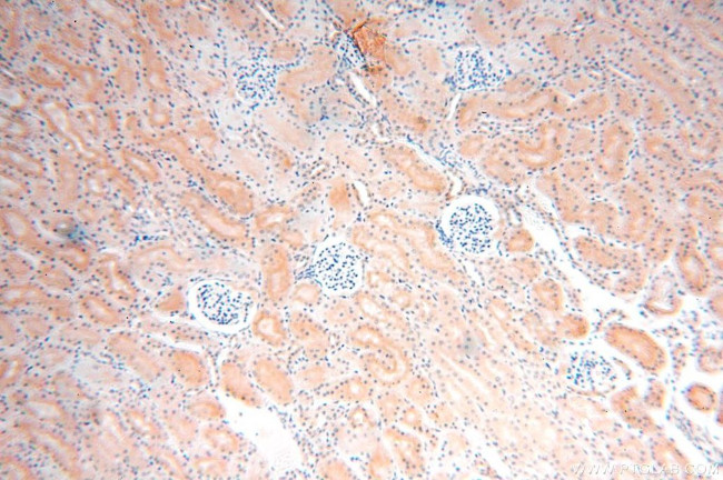 ATP6V0D1 Antibody in Immunohistochemistry (Paraffin) (IHC (P))