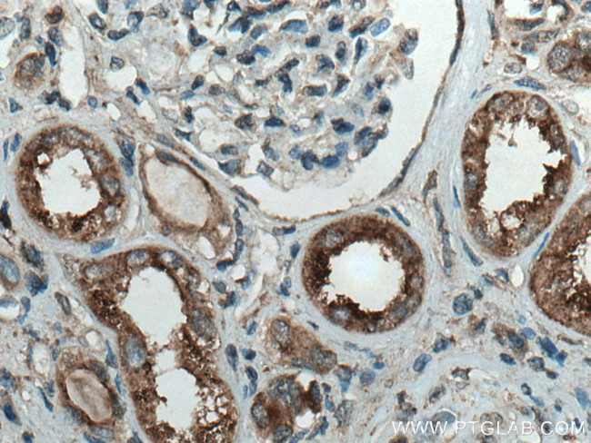 ATP6V0D1 Antibody in Immunohistochemistry (Paraffin) (IHC (P))