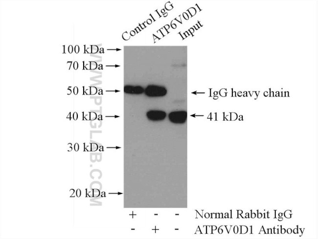 ATP6V0D1 Antibody in Immunoprecipitation (IP)