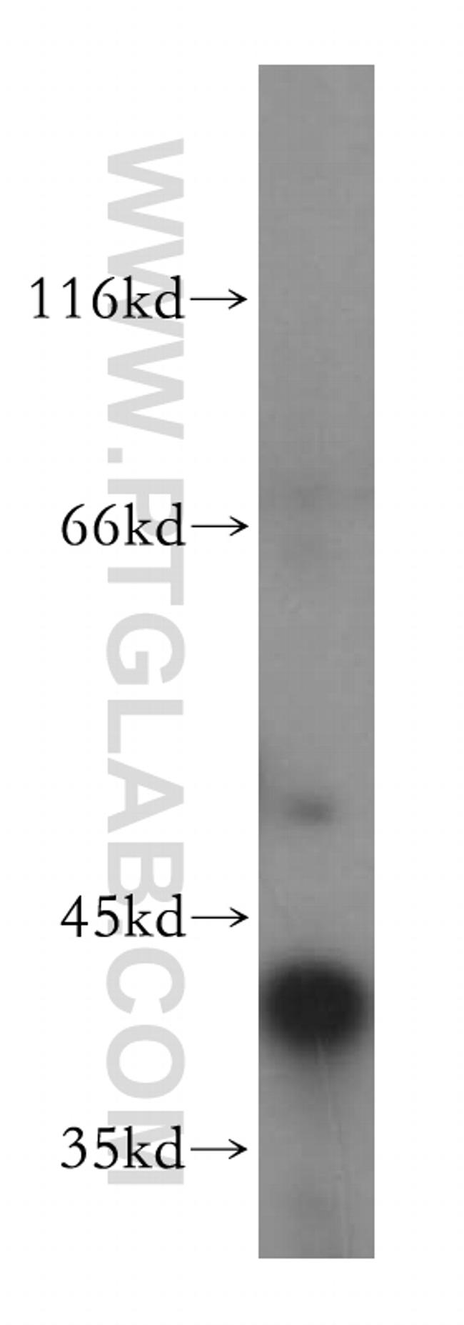 ATP6V0D1 Antibody in Western Blot (WB)