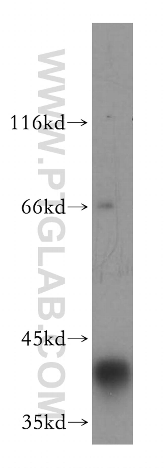 ATP6V0D1 Antibody in Western Blot (WB)