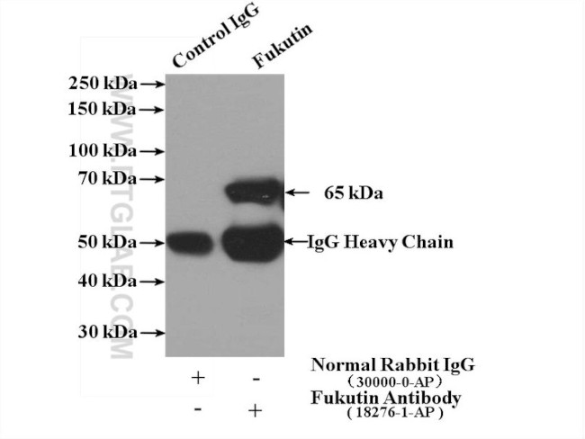 Fukutin Antibody in Immunoprecipitation (IP)