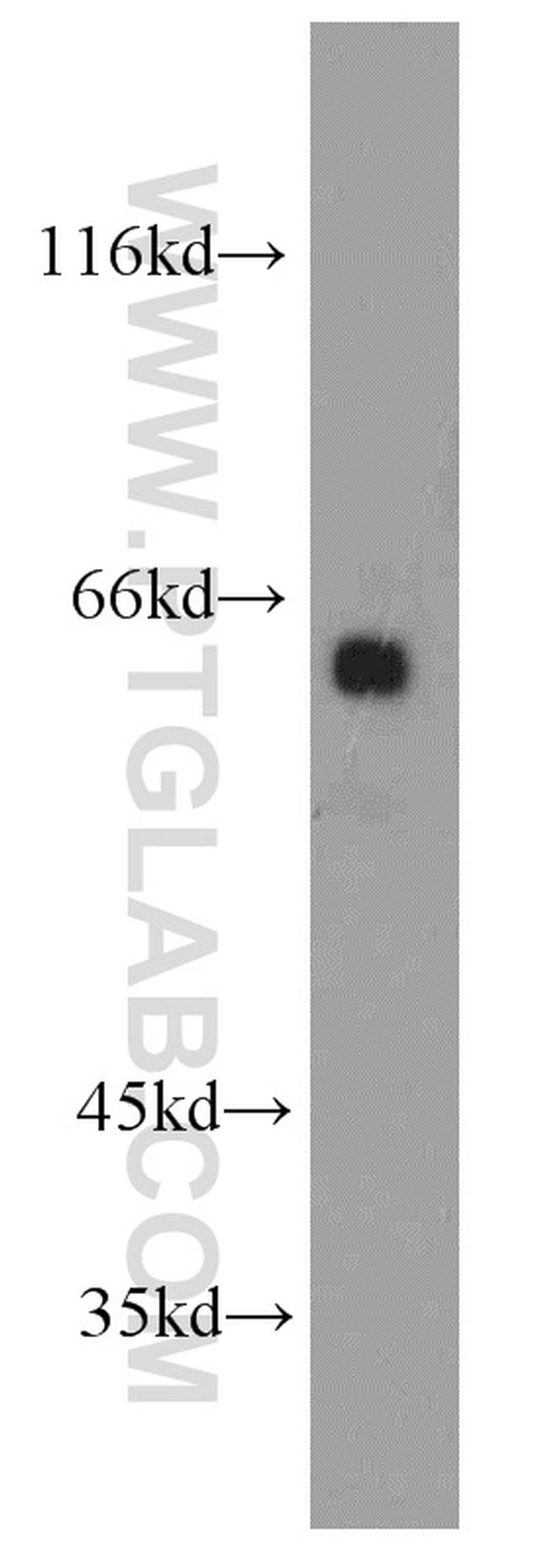 Fukutin Antibody in Western Blot (WB)