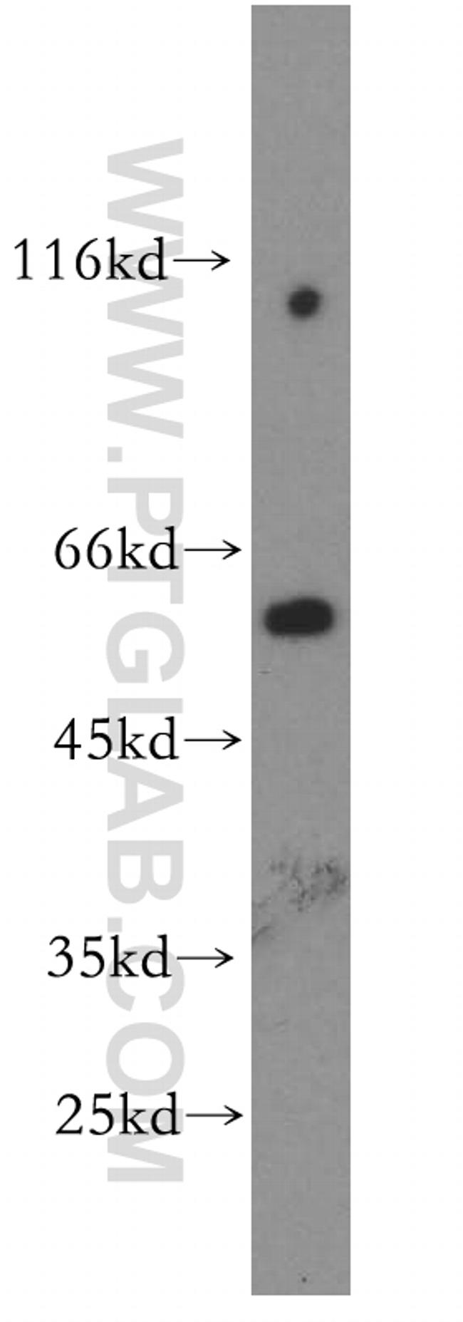 Fukutin Antibody in Western Blot (WB)