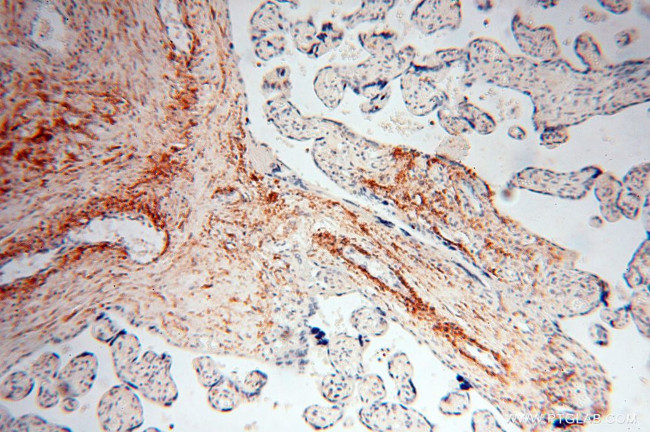 STRAP Antibody in Immunohistochemistry (Paraffin) (IHC (P))