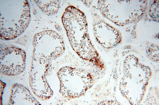 STRAP Antibody in Immunohistochemistry (Paraffin) (IHC (P))