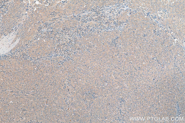 STRAP Antibody in Immunohistochemistry (Paraffin) (IHC (P))