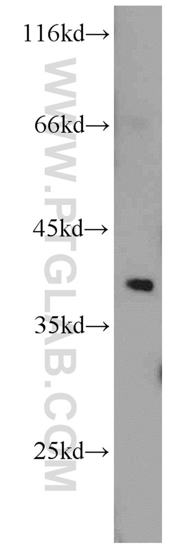 STRAP Antibody in Western Blot (WB)