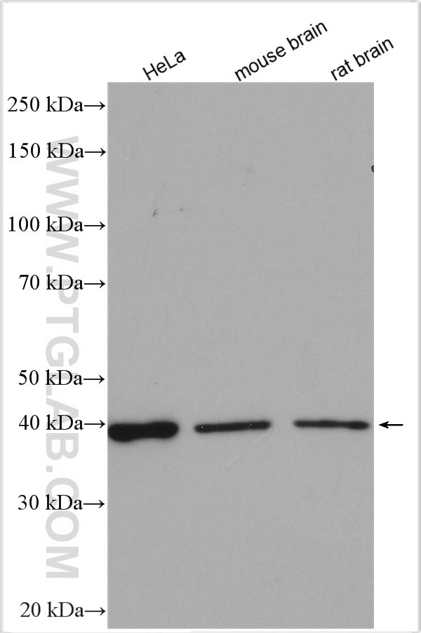 STRAP Antibody in Western Blot (WB)