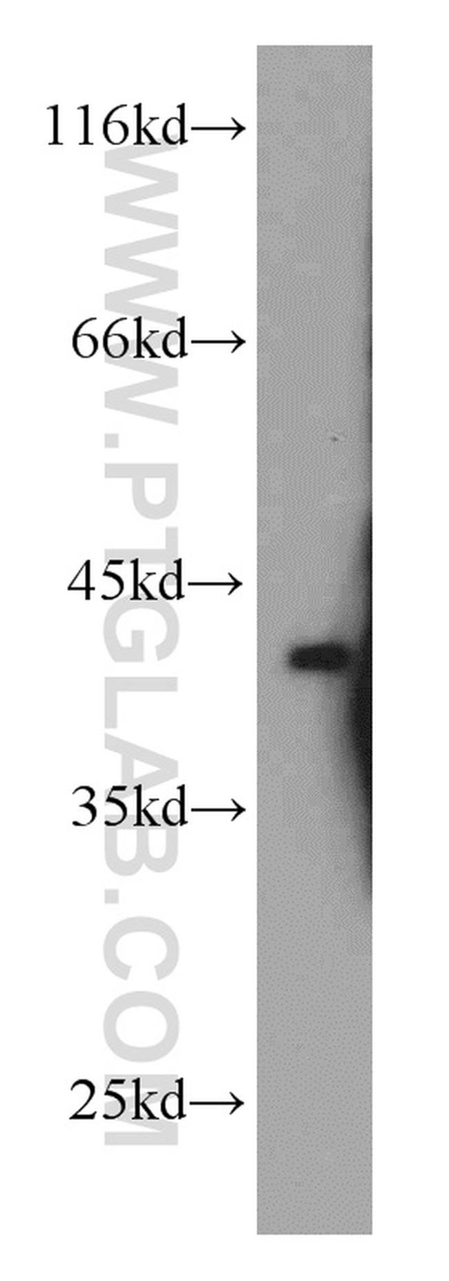 STRAP Antibody in Western Blot (WB)