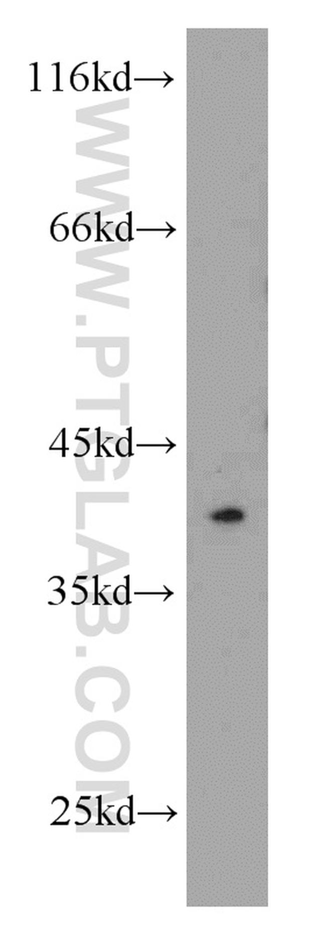 STRAP Antibody in Western Blot (WB)