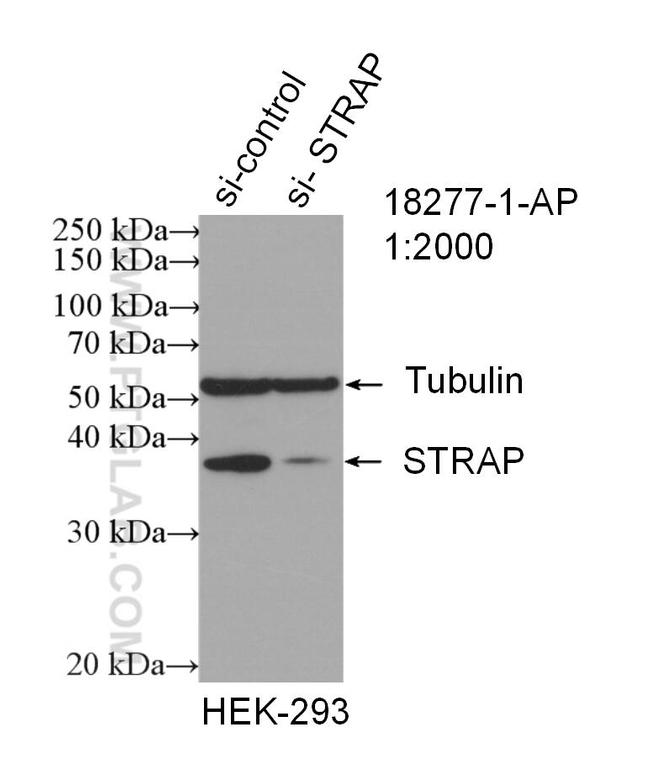 STRAP Antibody in Western Blot (WB)