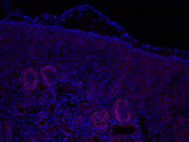 LMX1B Antibody in Immunohistochemistry (IHC)