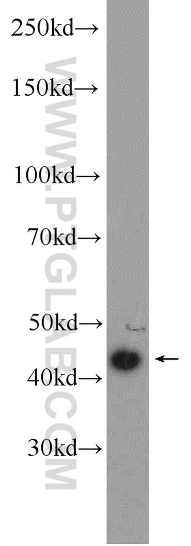 LMX1B Antibody in Western Blot (WB)