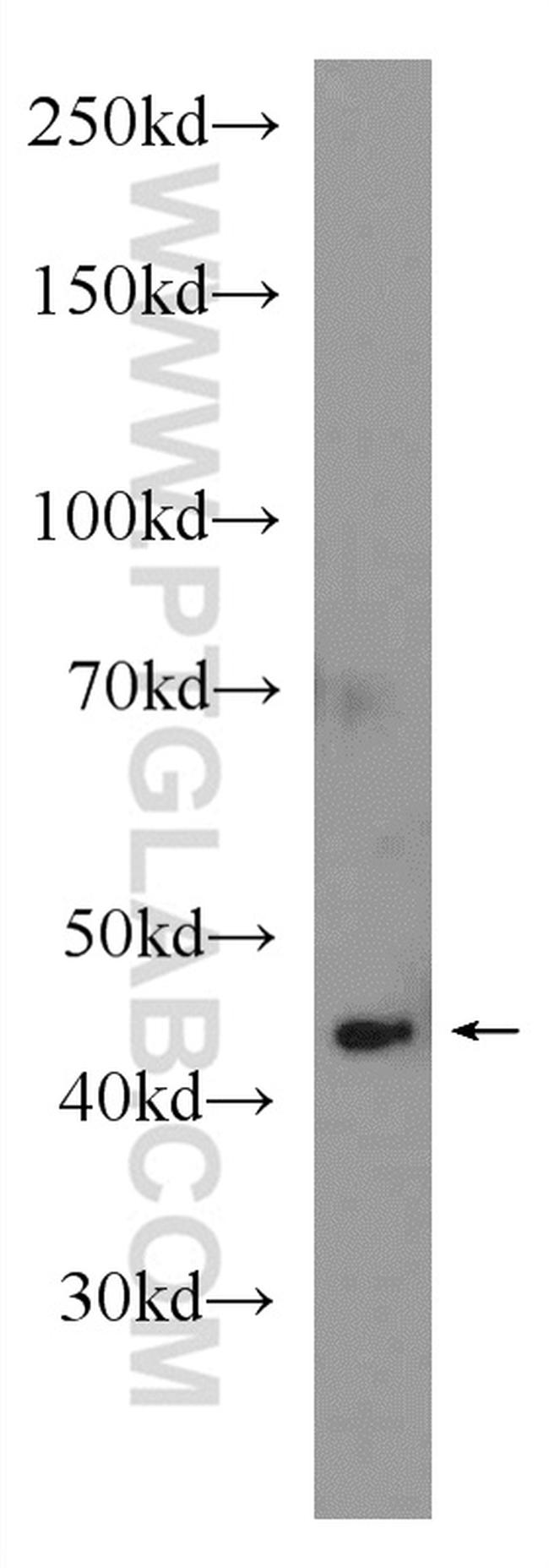 LMX1B Antibody in Western Blot (WB)