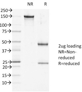 Desmoglein-1 (DSG1) Antibody in SDS-PAGE (SDS-PAGE)