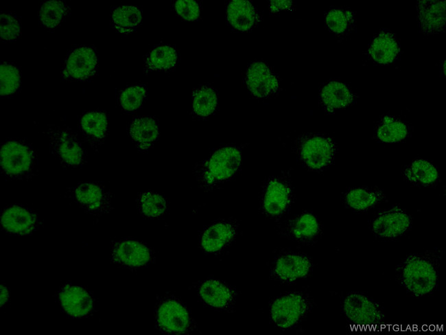 TDP-43 Antibody in Immunocytochemistry (ICC/IF)