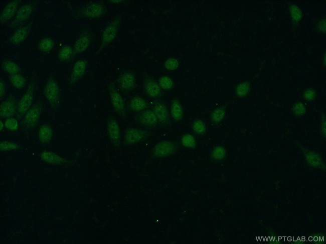 TDP-43 Antibody in Immunocytochemistry (ICC/IF)