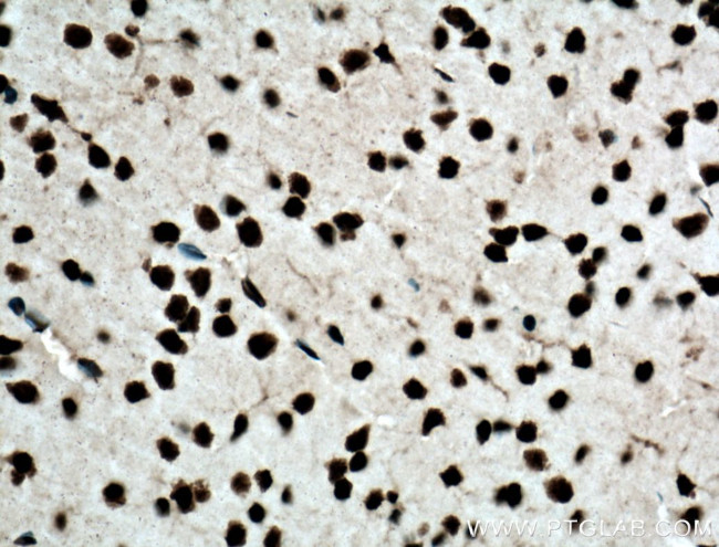 TDP-43 Antibody in Immunohistochemistry (Paraffin) (IHC (P))