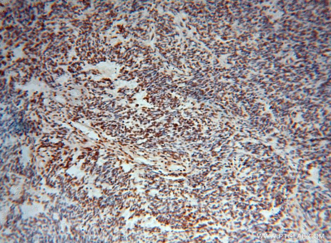 TDP-43 Antibody in Immunohistochemistry (Paraffin) (IHC (P))