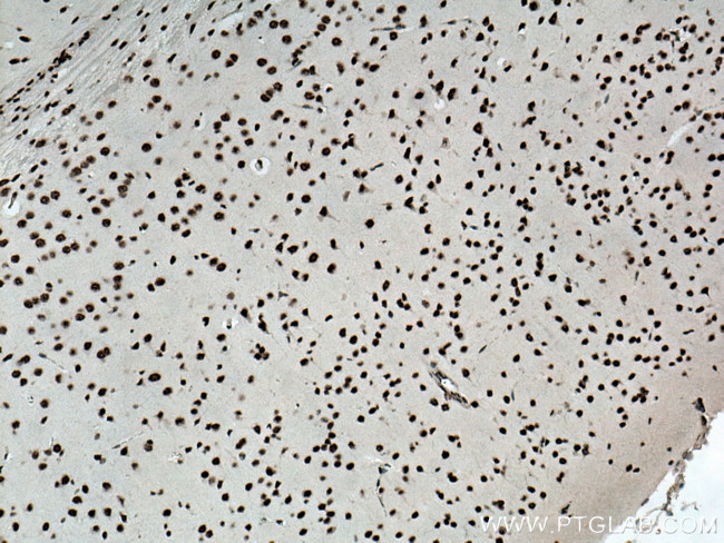 TDP-43 Antibody in Immunohistochemistry (Paraffin) (IHC (P))