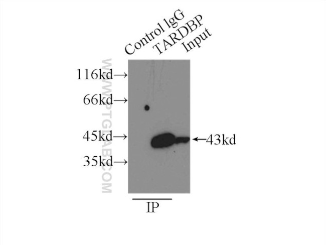 TDP-43 Antibody in Immunoprecipitation (IP)