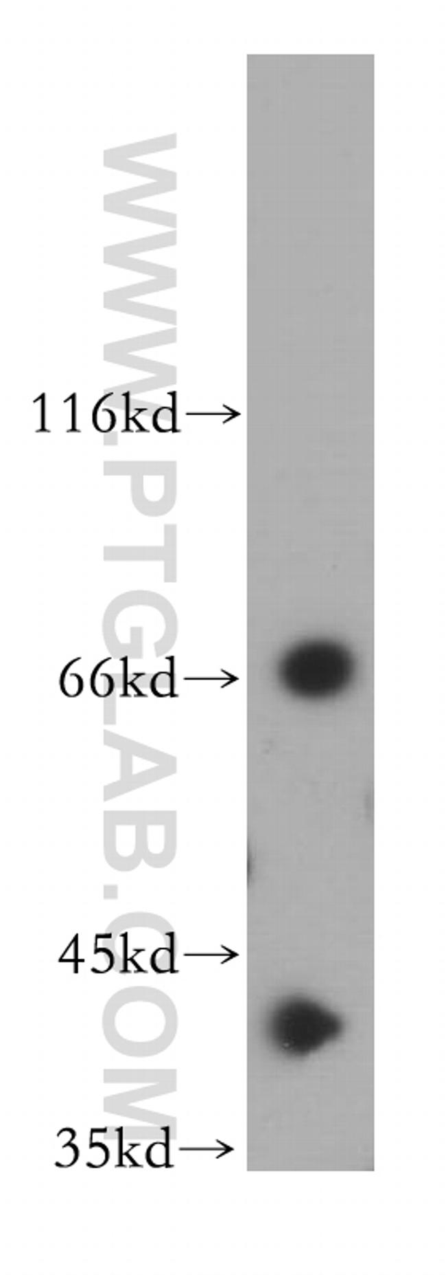 TDP-43 Antibody in Western Blot (WB)