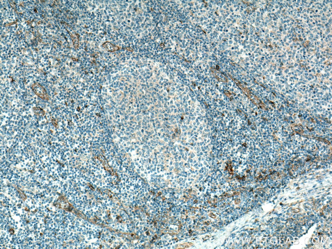 CD93 Antibody in Immunohistochemistry (Paraffin) (IHC (P))