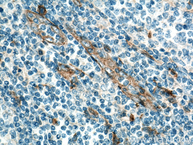 CD93 Antibody in Immunohistochemistry (Paraffin) (IHC (P))