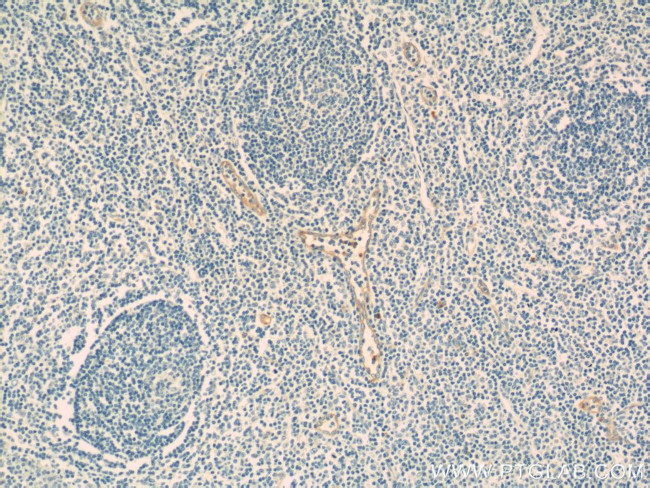 CD93 Antibody in Immunohistochemistry (Paraffin) (IHC (P))