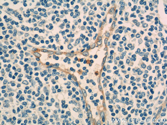 CD93 Antibody in Immunohistochemistry (Paraffin) (IHC (P))