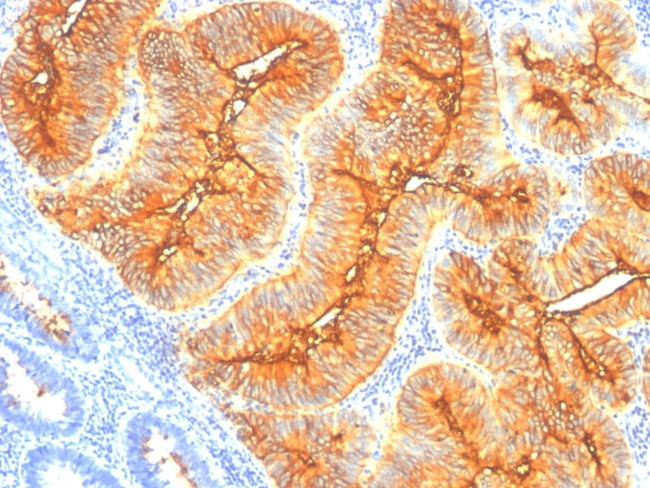 TAG-72/CA72.4 (Tumor-Associated Glycoprotein) Antibody in Immunohistochemistry (Paraffin) (IHC (P))