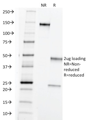 TAG-72/CA72.4 (Tumor-Associated Glycoprotein) Antibody in SDS-PAGE (SDS-PAGE)