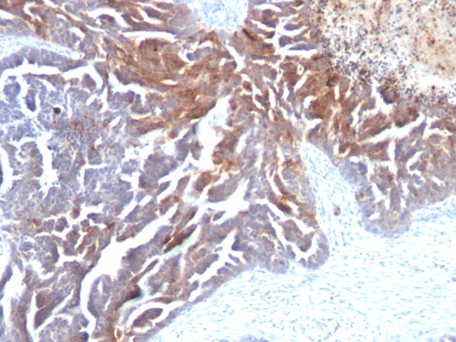 TAG-72/CA72.4 (Tumor-Associated Glycoprotein) Antibody in Immunohistochemistry (Paraffin) (IHC (P))