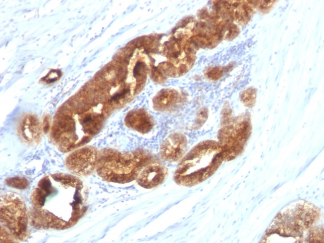 TAG-72/CA72.4 (Tumor-Associated Glycoprotein) Antibody in Immunohistochemistry (Paraffin) (IHC (P))