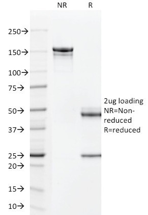 TAG-72/CA72.4 (Tumor-Associated Glycoprotein) Antibody in SDS-PAGE (SDS-PAGE)