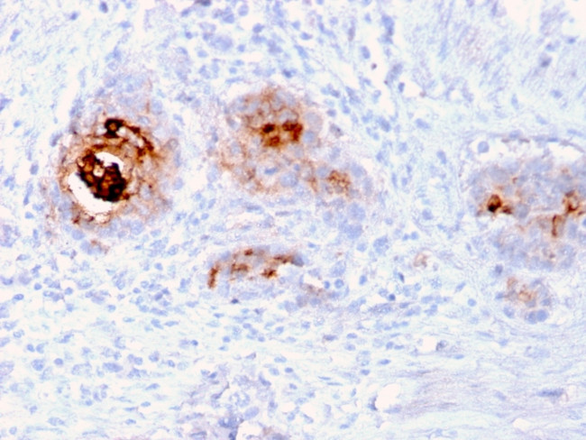 TAG-72/CA72.4 (Tumor-Associated Glycoprotein) Antibody in Immunohistochemistry (Paraffin) (IHC (P))