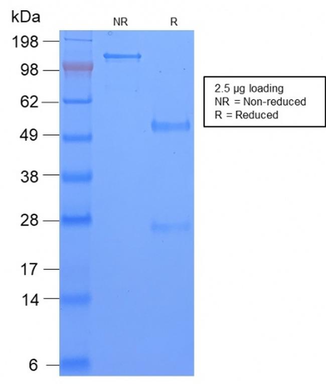 TAG-72/CA72.4 (Tumor-Associated Glycoprotein) Antibody in SDS-PAGE (SDS-PAGE)