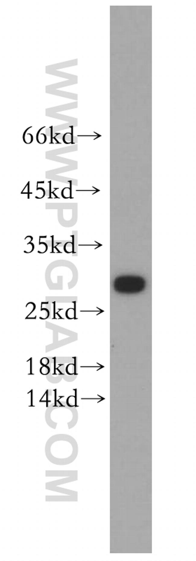 KCNE4 Antibody in Western Blot (WB)