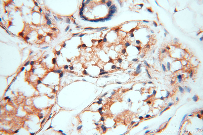 MEF2C Antibody in Immunohistochemistry (Paraffin) (IHC (P))