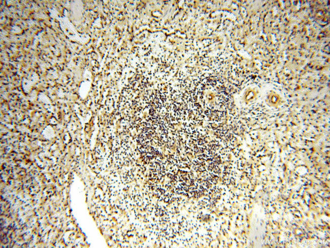 MEF2C Antibody in Immunohistochemistry (Paraffin) (IHC (P))