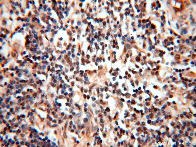 MEF2C Antibody in Immunohistochemistry (Paraffin) (IHC (P))