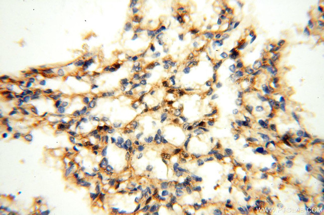 MEF2C Antibody in Immunohistochemistry (Paraffin) (IHC (P))