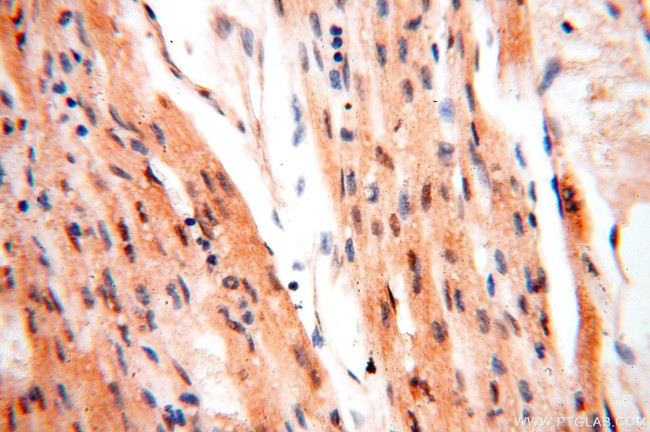 MEF2C Antibody in Immunohistochemistry (Paraffin) (IHC (P))