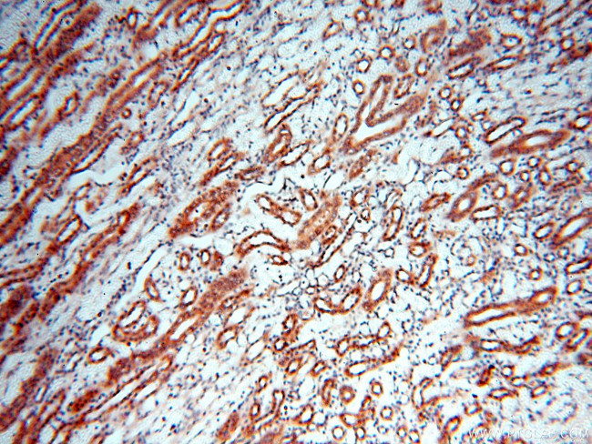 MEF2C Antibody in Immunohistochemistry (Paraffin) (IHC (P))