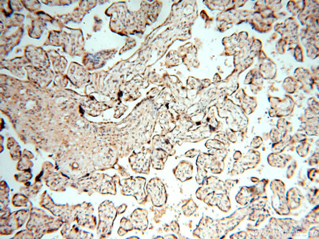 MEF2C Antibody in Immunohistochemistry (Paraffin) (IHC (P))